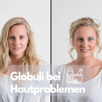 Globuli bei Hautproblemen? Ursachen klären – sachliche Einordnung und Sicherheit