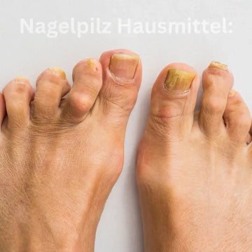 Nagelpilz: Hausmittel und wirksame Behandlung – sachliche Einordnung und Sicherheit