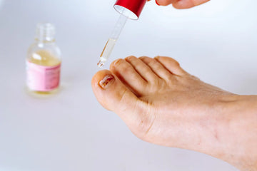 Nagelpilz erkennen und wirksam behandeln – sachliche Einordnung und Sicherheit