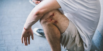 DMSO auf offenen Wunden: Nicht selbst anwenden – sachliche Einordnung und Sicherheit