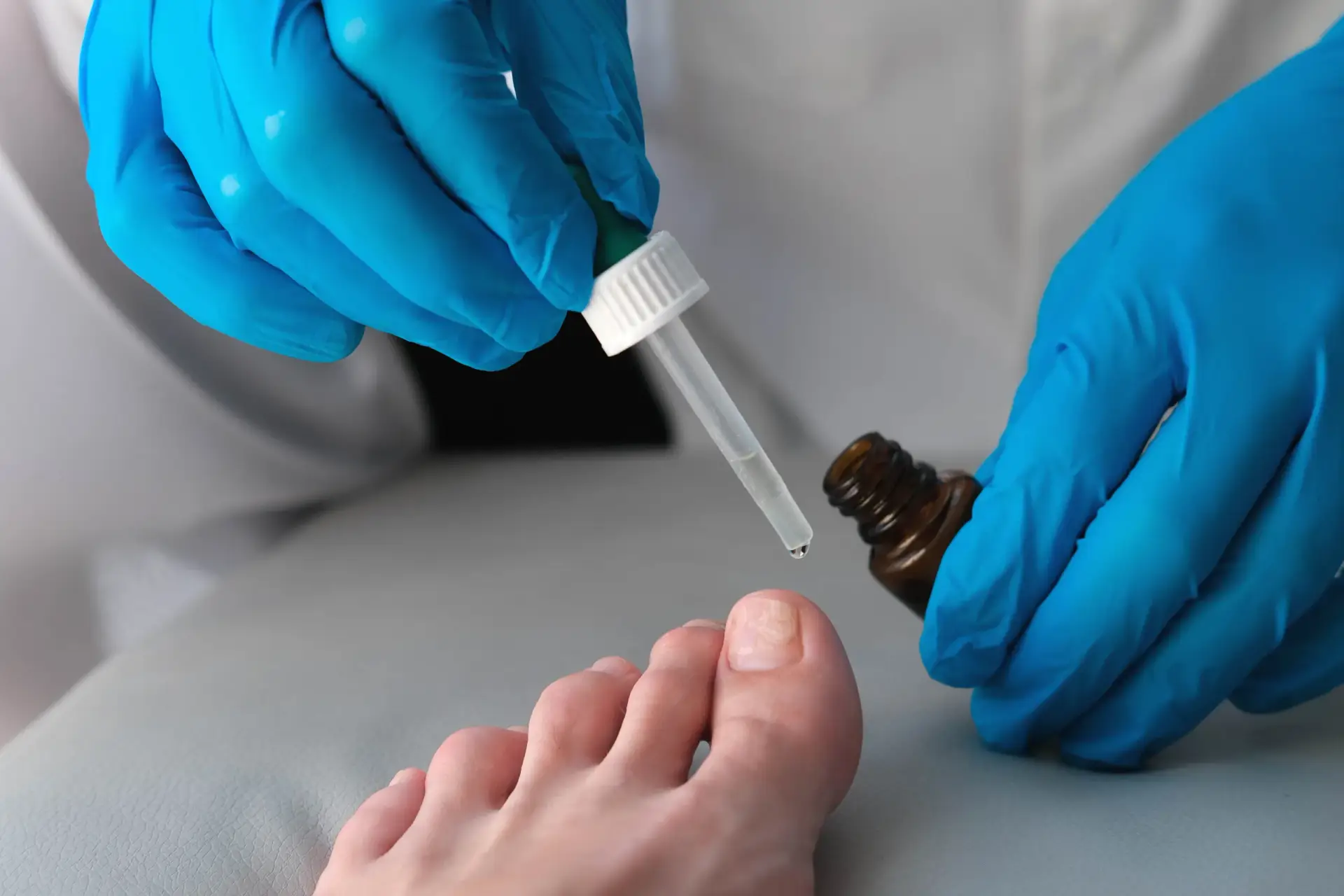 Nagelpilz, Onychomykose, schnelle Heilung, Lasertherapie, pharmazeutische Entwicklungen, Dermatologie, Hautpflege, Fußgesundheit, Pilzinfektionen, antimykotische Behandlung, Gesundheit und Wellness, medizinische Mythen, Patientenberatung, effektive Behandlungen, Heilungsprozess, Dermatologen, Studien zu Nagelpilz