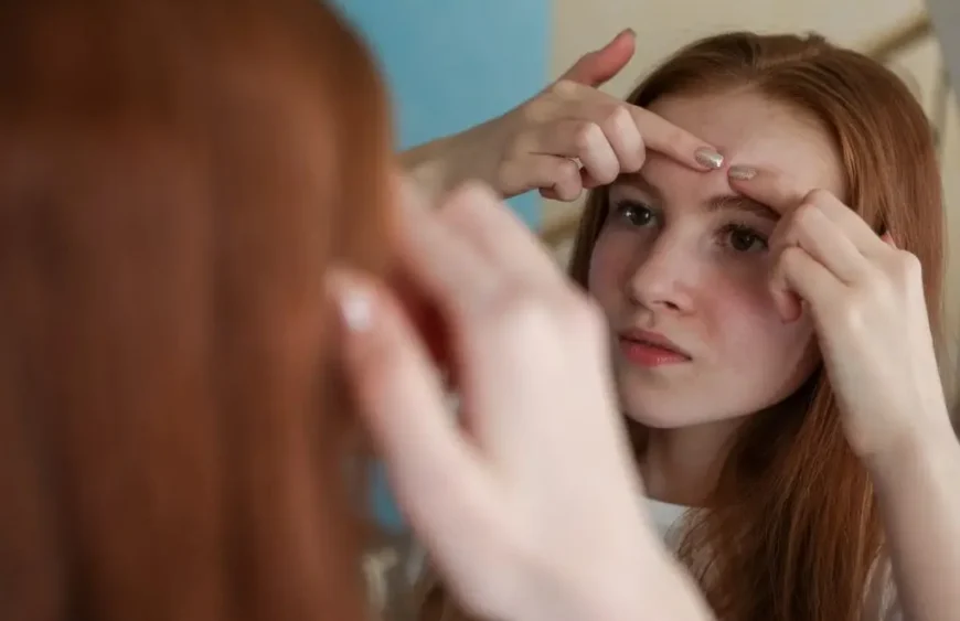 10 effektive Tipps gegen Akne: Ein natürlicher Ansatz