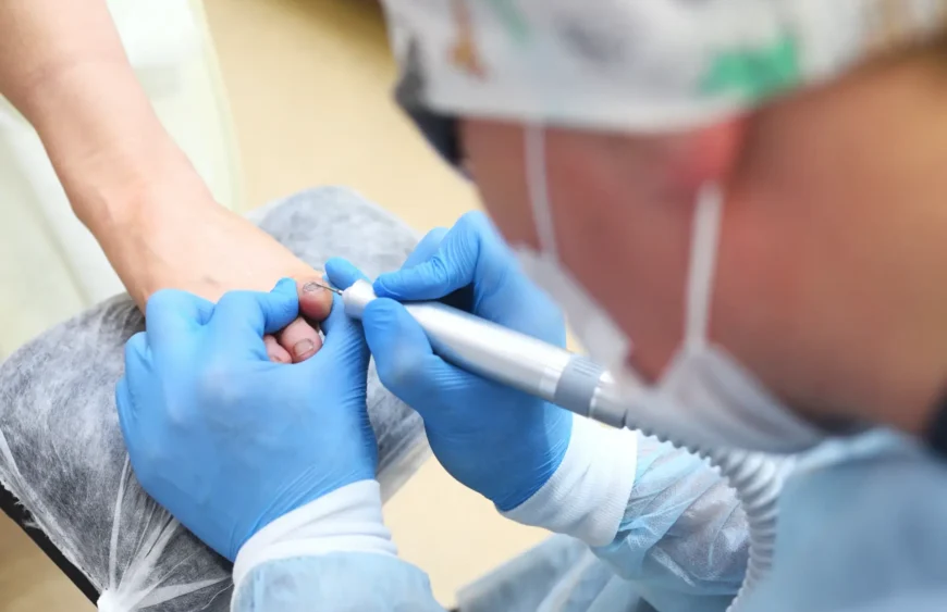 Effektive Methoden zur schnellen und intensiven Nagelpilzbehandlung