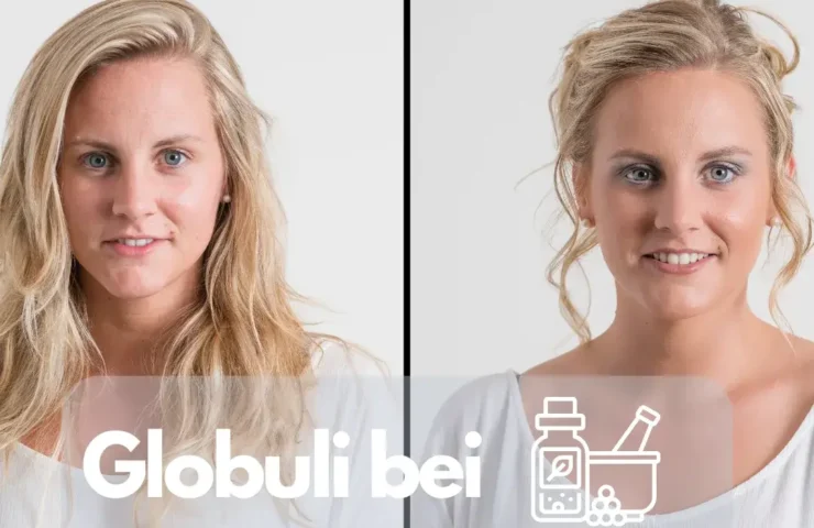 Globuli bei Hautproblemen: Sanfte Behandlung von Akne, Ekzemen und Juckreiz Hautprobleme wie Akne, Ekzeme und Juckreiz können eine große Belastung sein und die Lebensqualität beeinträchtigen. Viele Menschen suchen nach sanften Alternativen zur konventionellen Hautpflege und -behandlung. Homöopathische Globuli bieten eine natürliche Möglichkeit zur Unterstützung der Hautgesundheit, indem sie auf die individuellen Ursachen und Erscheinungsformen der Hautbeschwerden abgestimmt sind. Hier stellen wir Ihnen die wichtigsten Globuli für verschiedene Hautprobleme vor, einschließlich Akne, Ekzeme und Juckreiz, sowie Empfehlungen zur Potenz und Dosierung.