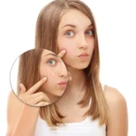 Reine Haut Tabletten mit Zink