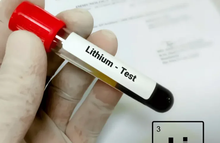 Lithium‑Blutwert einfach erklärt: Lithiumspiegel bestimmen, Zielbereiche, Timing & typische Fehler