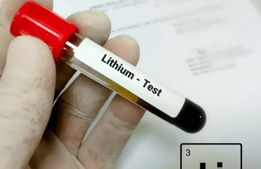 Lithium‑Blutwert einfach erklärt: Lithiumspiegel bestimmen, Zielbereiche, Timing & typische Fehler